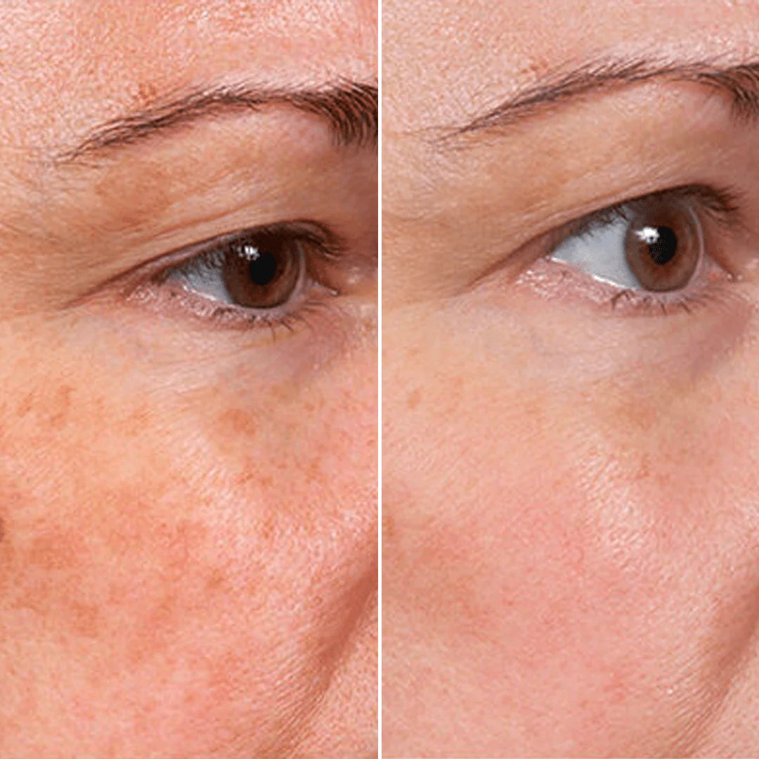 Rejuvenate Face Serum