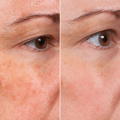 Rejuvenate Face Serum